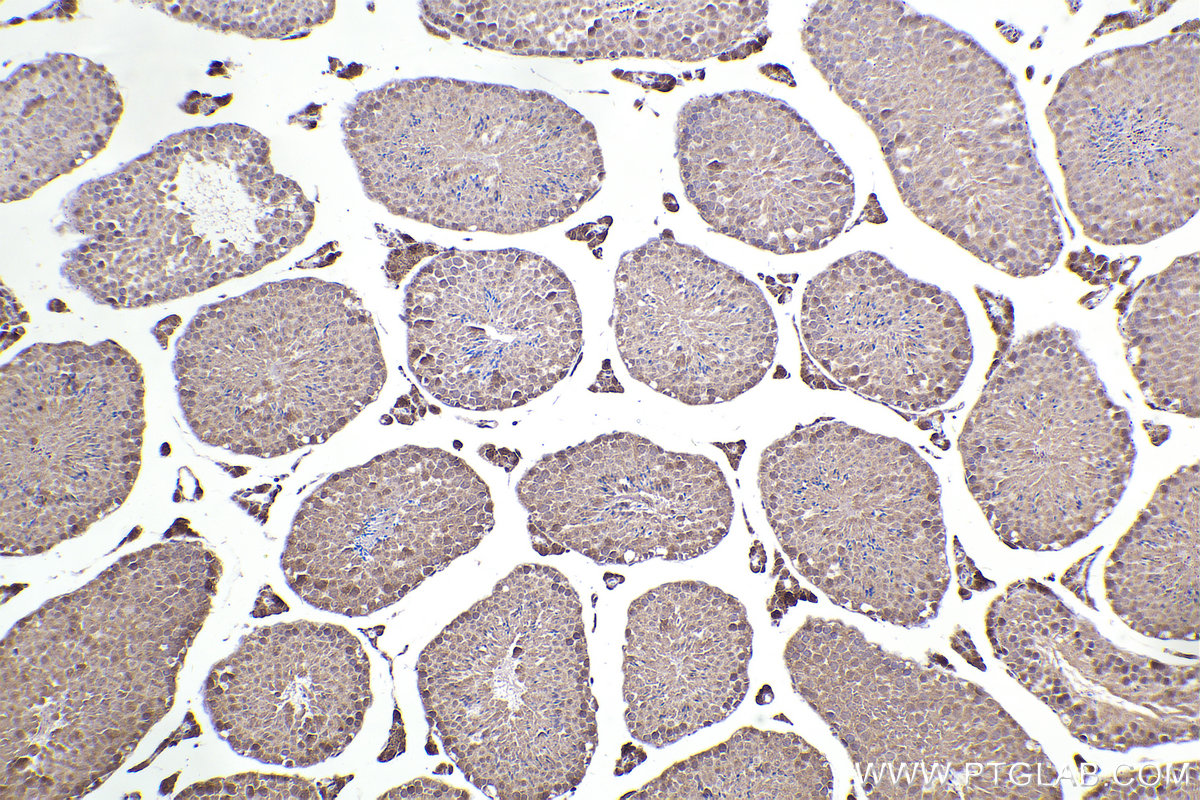 Immunohistochemical analysis of paraffin-embedded mouse testis tissue slide using KHC2298 (KNTC1 IHC Kit).