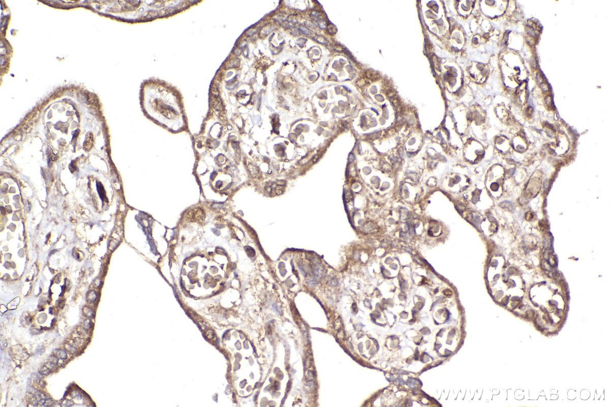 Immunohistochemical analysis of paraffin-embedded human placenta tissue slide using KHC2298 (KNTC1 IHC Kit).