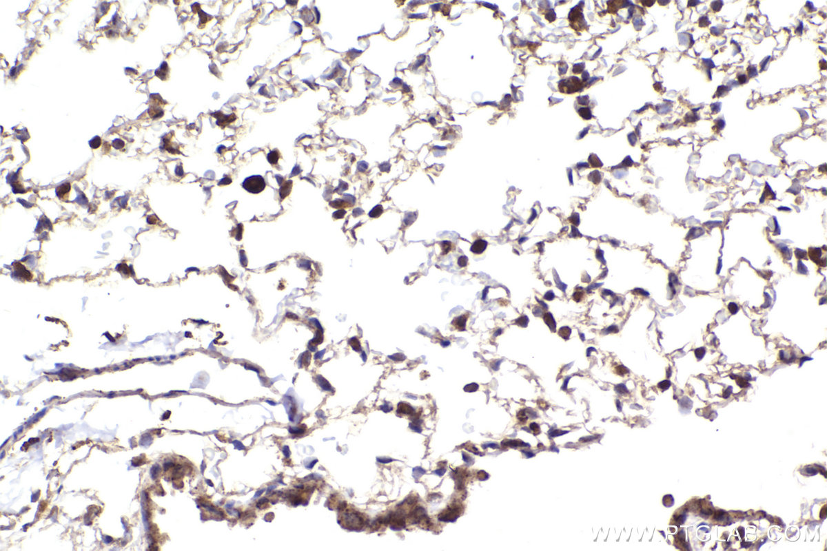 Immunohistochemical analysis of paraffin-embedded mouse lung tissue slide using KHC2298 (KNTC1 IHC Kit).