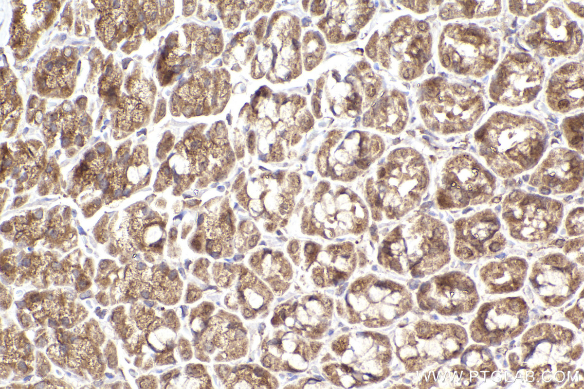Immunohistochemical analysis of paraffin-embedded rat stomach tissue slide using KHC2298 (KNTC1 IHC Kit).