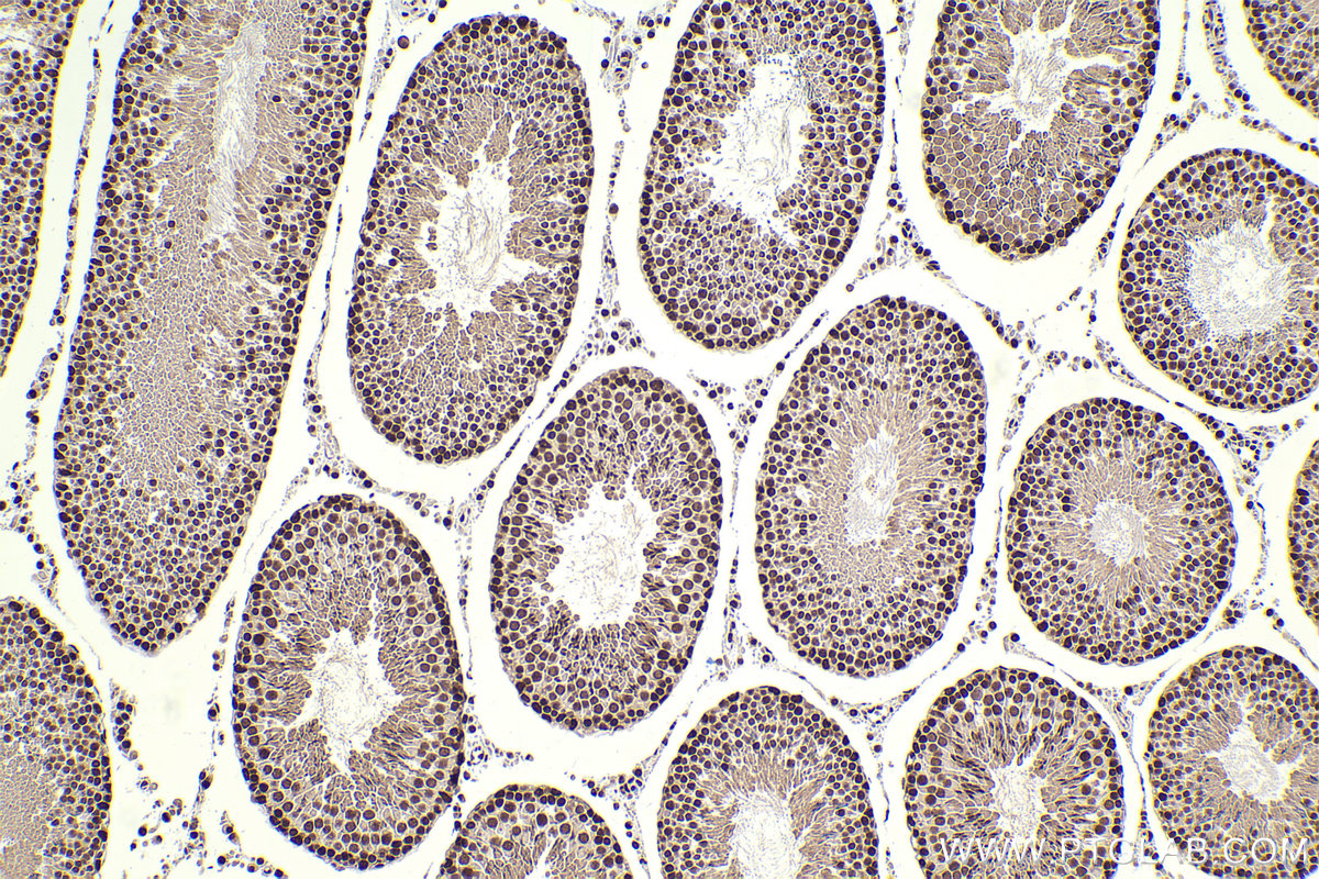 Immunohistochemical analysis of paraffin-embedded rat testis tissue slide using KHC2310 (KPNA1 IHC Kit).