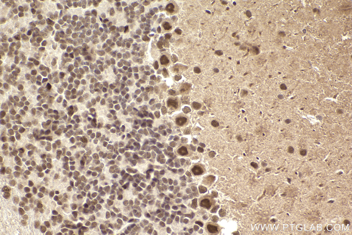 Immunohistochemical analysis of paraffin-embedded mouse cerebellum tissue slide using KHC2310 (KPNA1 IHC Kit).