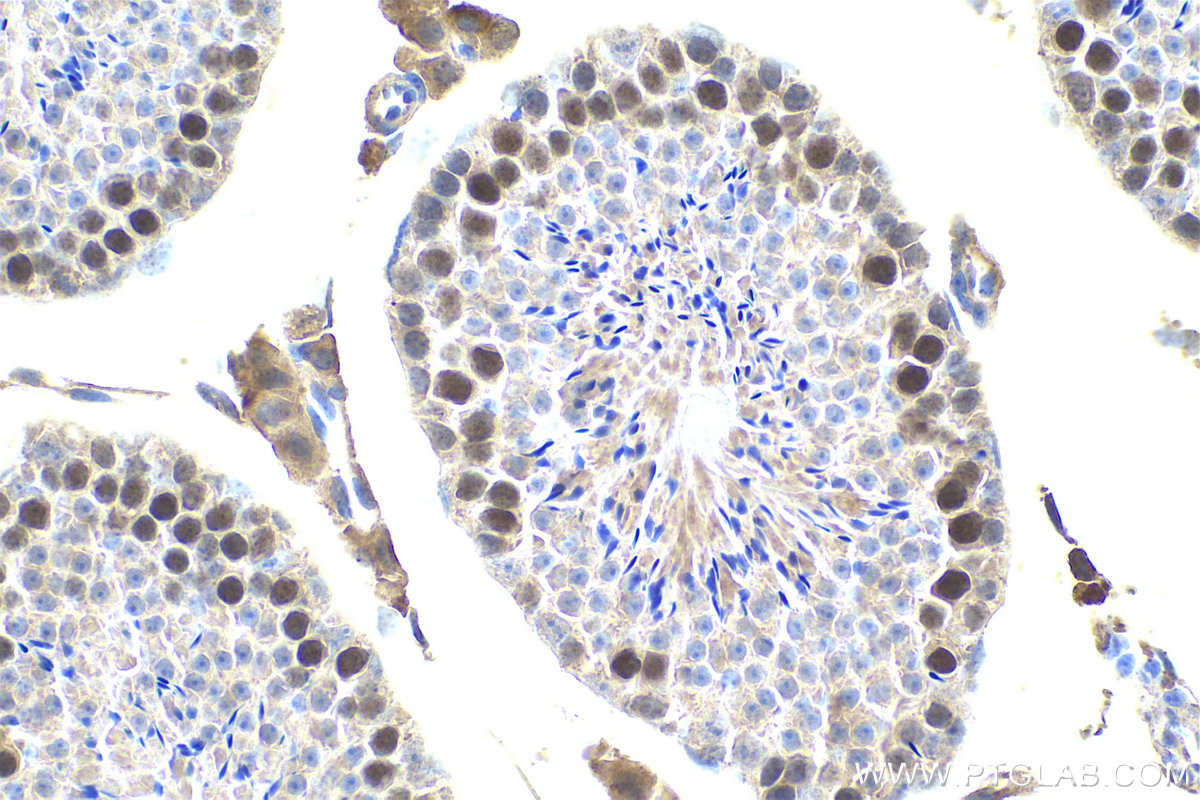 Immunohistochemical analysis of paraffin-embedded mouse testis tissue slide using KHC0799 (KPNA2 IHC Kit).