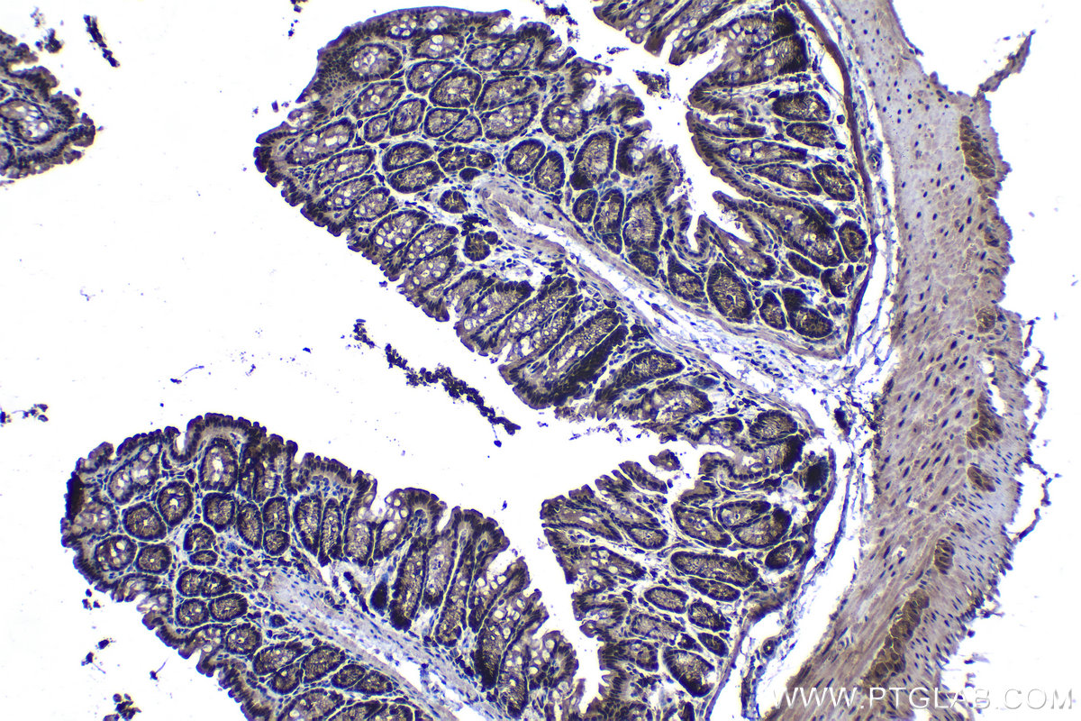 Immunohistochemical analysis of paraffin-embedded mouse colon tissue slide using KHC1242 (KPNA3 IHC Kit).