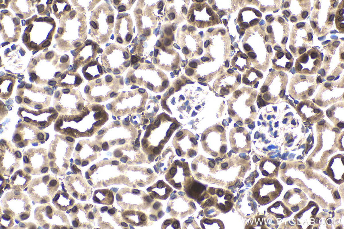 Immunohistochemical analysis of paraffin-embedded mouse kidney tissue slide using KHC1742 (KPNB1 IHC Kit).