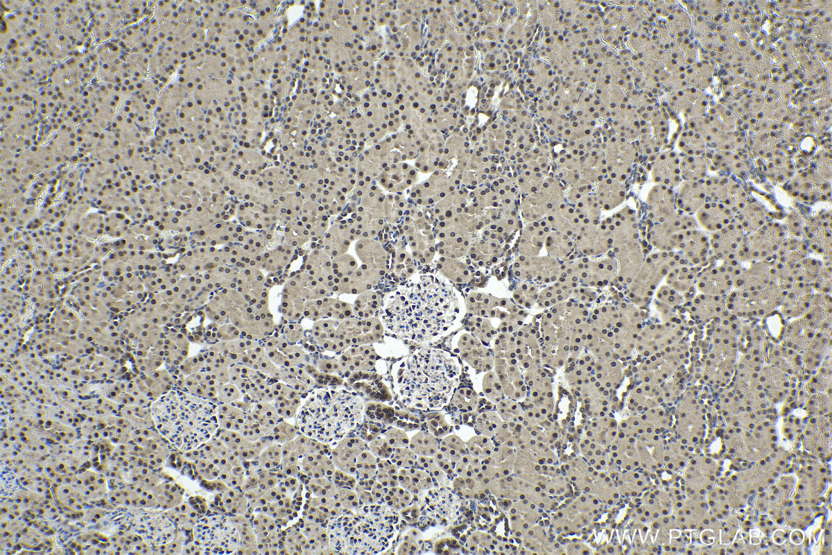 Immunohistochemical analysis of paraffin-embedded rat kidney tissue slide using KHC1742 (KPNB1 IHC Kit).