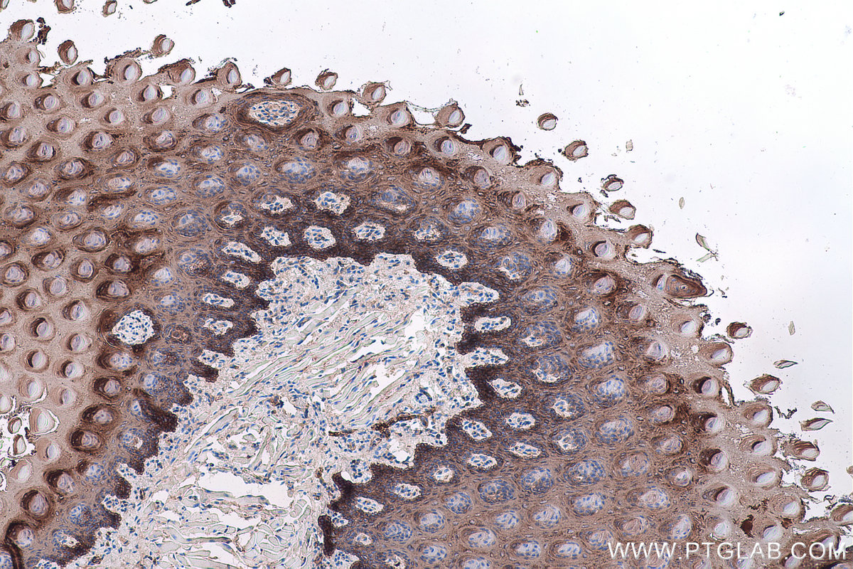 Immunohistochemical analysis of paraffin-embedded mouse tongue tissue slide using KHC0750 (KRT13 IHC Kit).