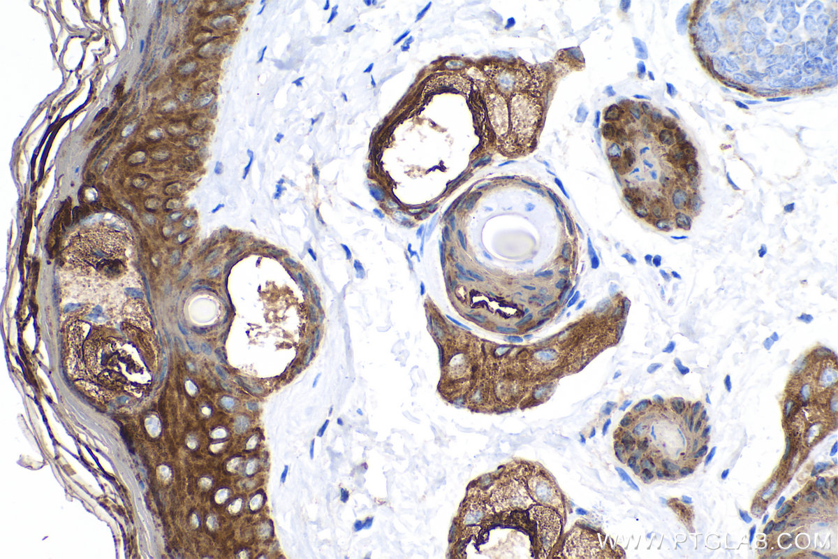 Immunohistochemical analysis of paraffin-embedded mouse skin tissue slide using KHC0752 (KRT15 IHC Kit).