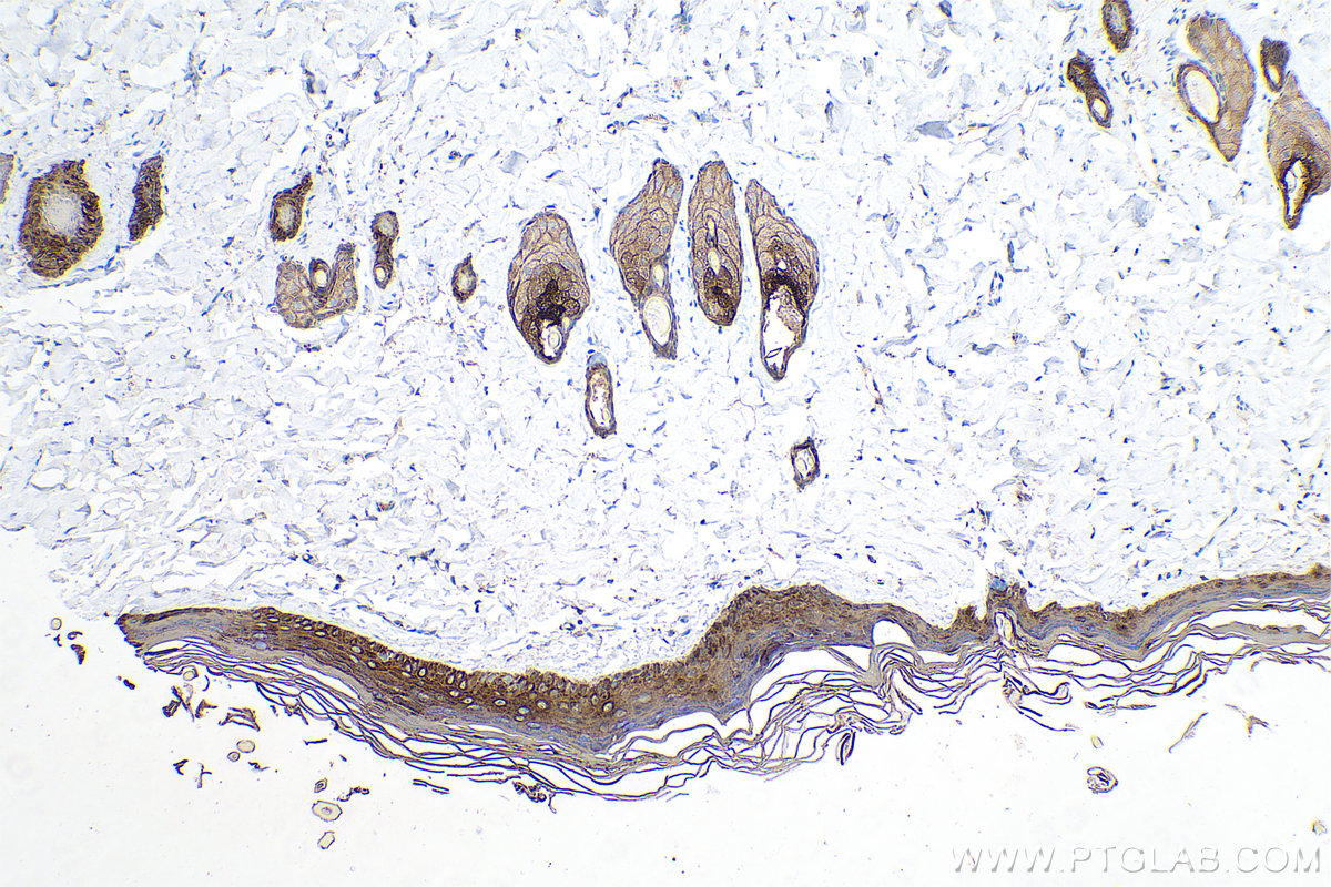 Immunohistochemical analysis of paraffin-embedded rat skin tissue slide using KHC0752 (KRT15 IHC Kit).