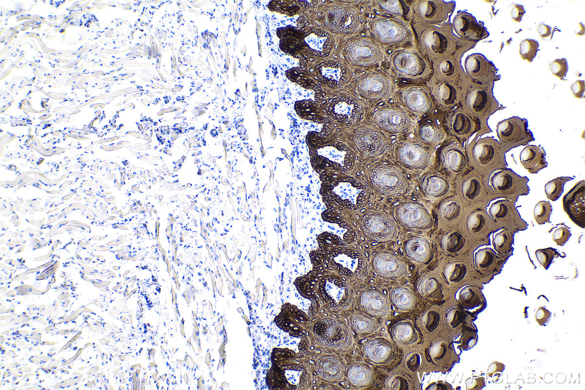 Immunohistochemical analysis of paraffin-embedded rat tongue tissue slide using KHC0752 (KRT15 IHC Kit).