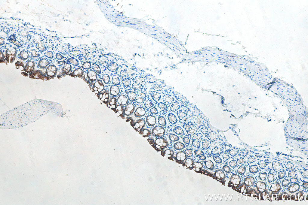 Immunohistochemical analysis of paraffin-embedded rat colon tissue slide using KHC0033 (Cytokeratin 19 IHC Kit).