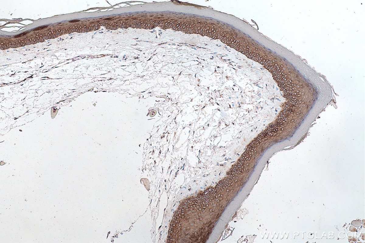 Immunohistochemical analysis of paraffin-embedded mouse skin tissue slide using KHC0745 (KRT2 IHC Kit).