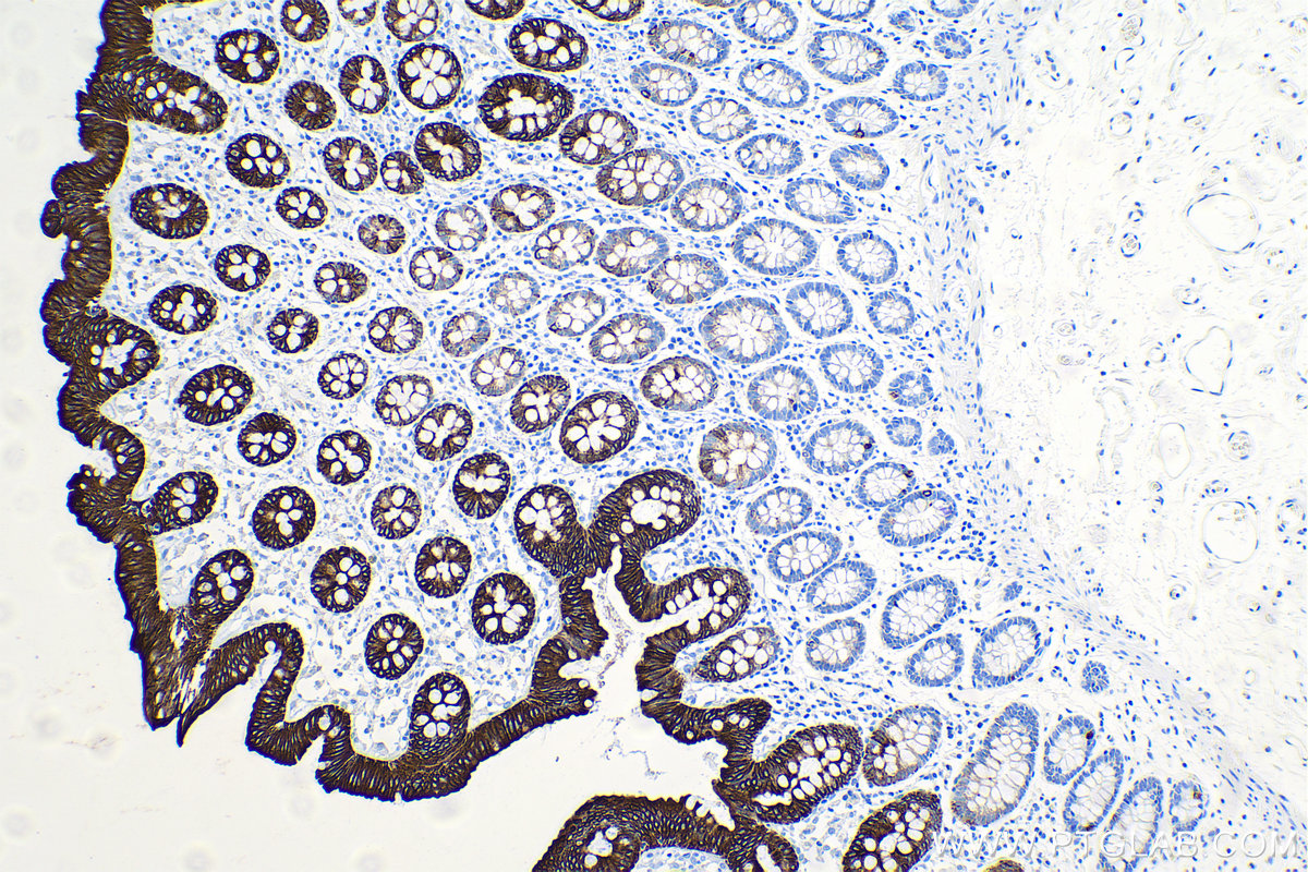 Immunohistochemical analysis of paraffin-embedded human colon tissue slide using KHC0034 (KRT20 IHC Kit).