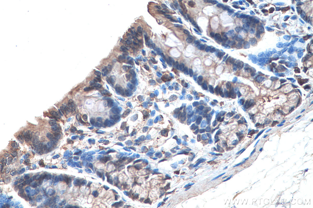 Immunohistochemical analysis of paraffin-embedded rat colon tissue slide using KHC0268 (KRT23 IHC Kit).