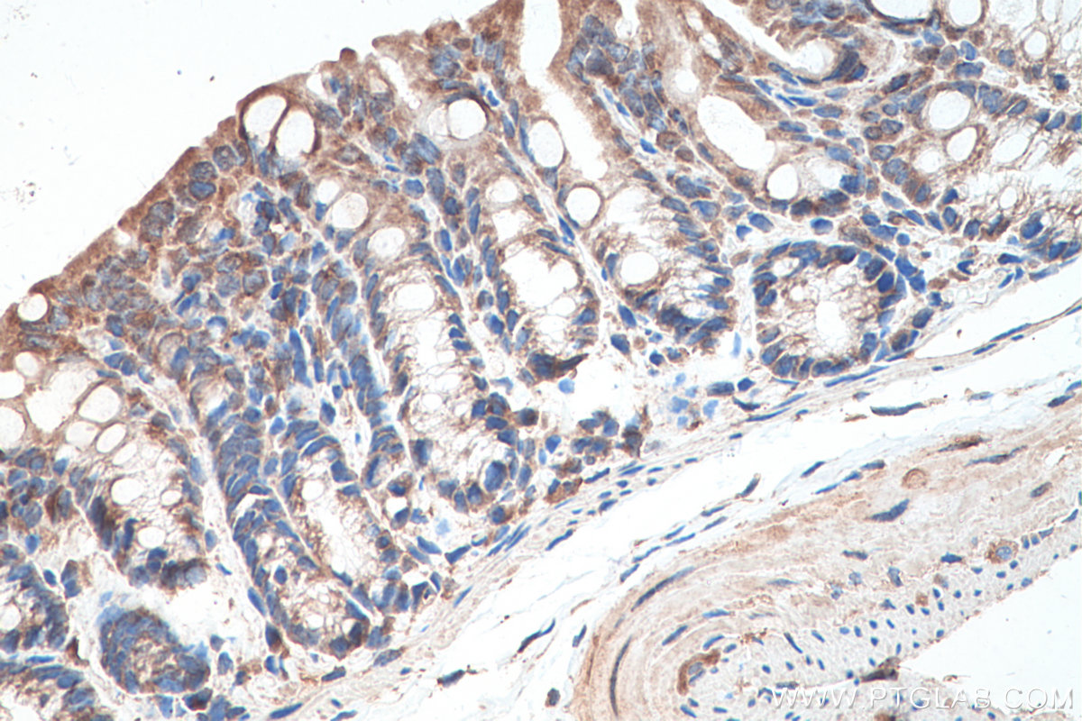 Immunohistochemical analysis of paraffin-embedded mouse colon tissue slide using KHC0268 (KRT23 IHC Kit).