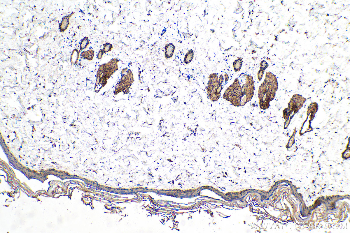 Immunohistochemical analysis of paraffin-embedded rat skin tissue slide using KHC0754 (KRT33B IHC Kit).