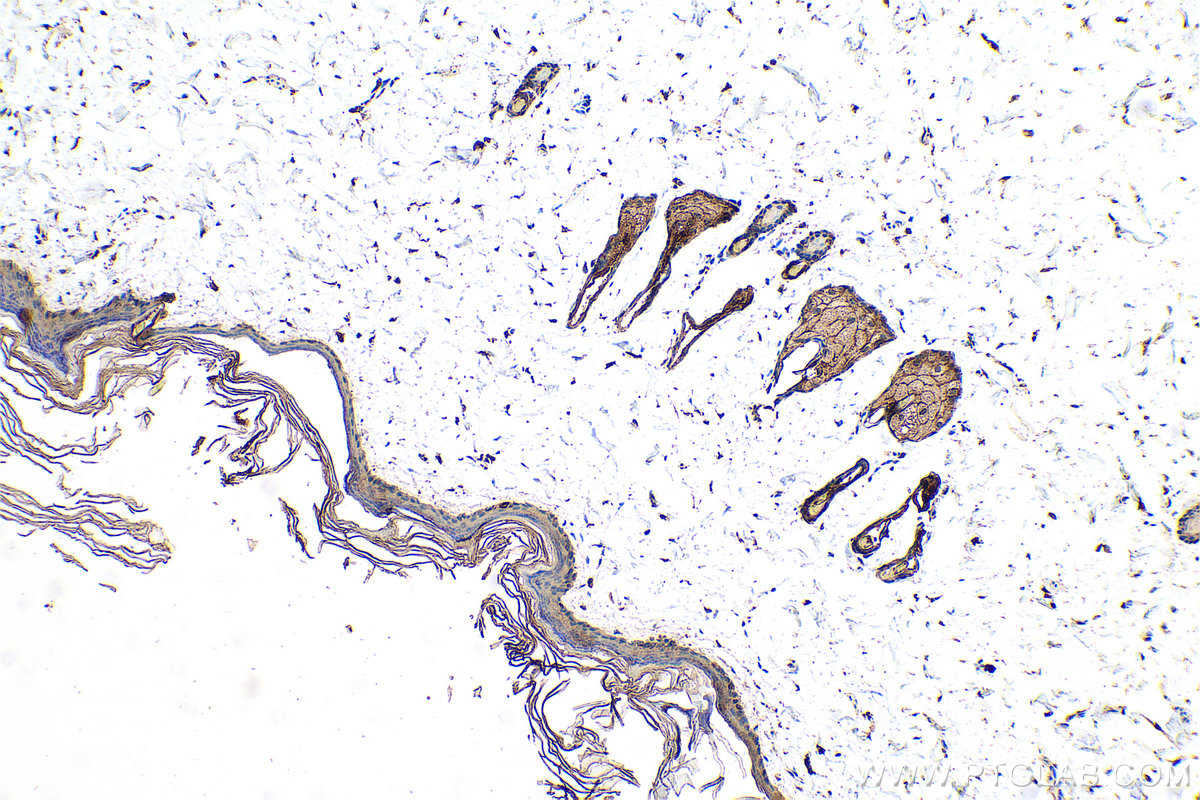 Immunohistochemical analysis of paraffin-embedded rat skin tissue slide using KHC0755 (KRT34 IHC Kit).