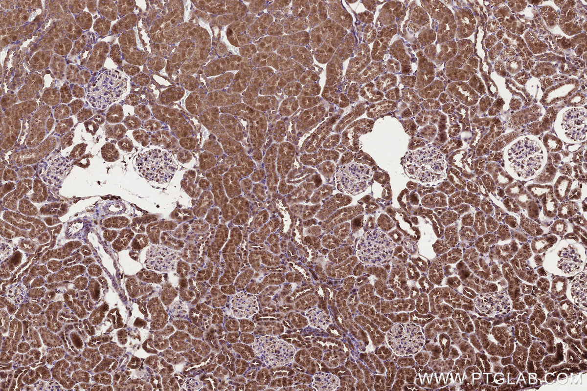 Immunohistochemical analysis of paraffin-embedded rat kidney tissue slide using KHC3292 (KTELC1 IHC Kit). Immunohistochemical analysis of paraffin-embedded rat kidney tissue slide using KHC3292 (KTELC1 IHC Kit).