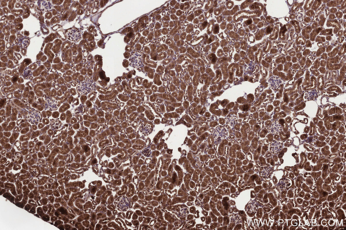 Immunohistochemical analysis of paraffin-embedded mouse kidney tissue slide using KHC3292 (KTELC1 IHC Kit). Immunohistochemical analysis of paraffin-embedded mouse kidney tissue slide using KHC3292 (KTELC1 IHC Kit).