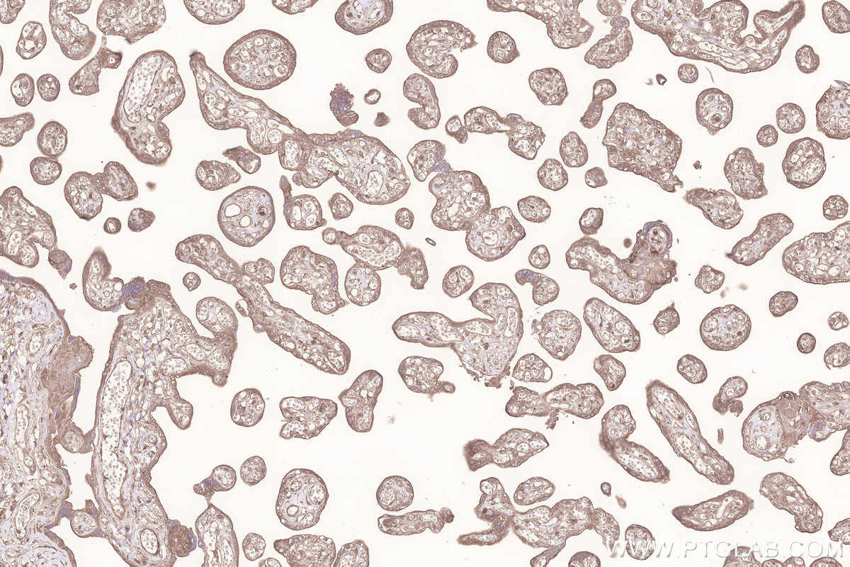 Immunohistochemical analysis of paraffin-embedded human placenta tissue slide using KHC3292 (KTELC1 IHC Kit). Immunohistochemical analysis of paraffin-embedded human placenta tissue slide using KHC3292 (KTELC1 IHC Kit).