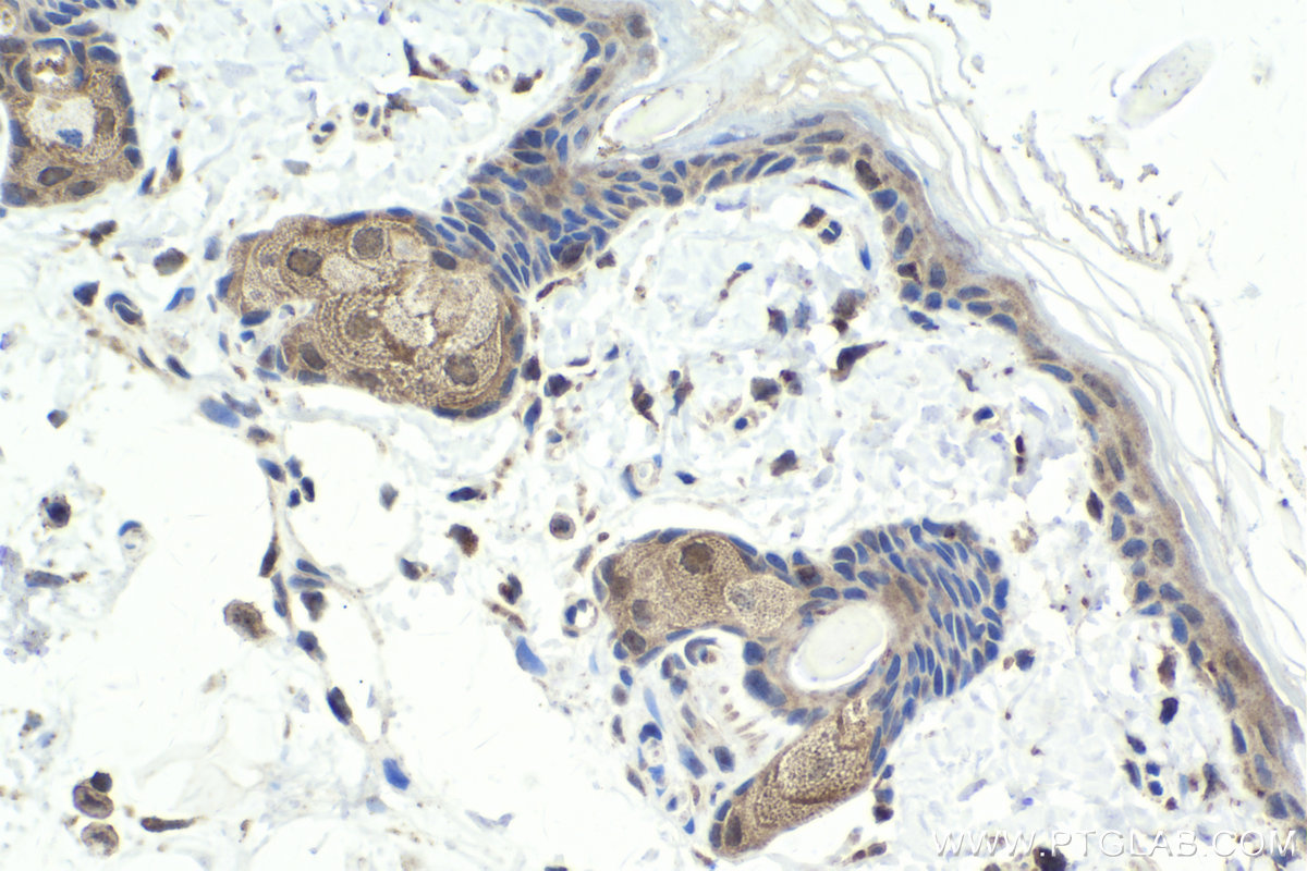 Immunohistochemical analysis of paraffin-embedded rat skin tissue slide using KHC1785 (Kazrin IHC Kit).