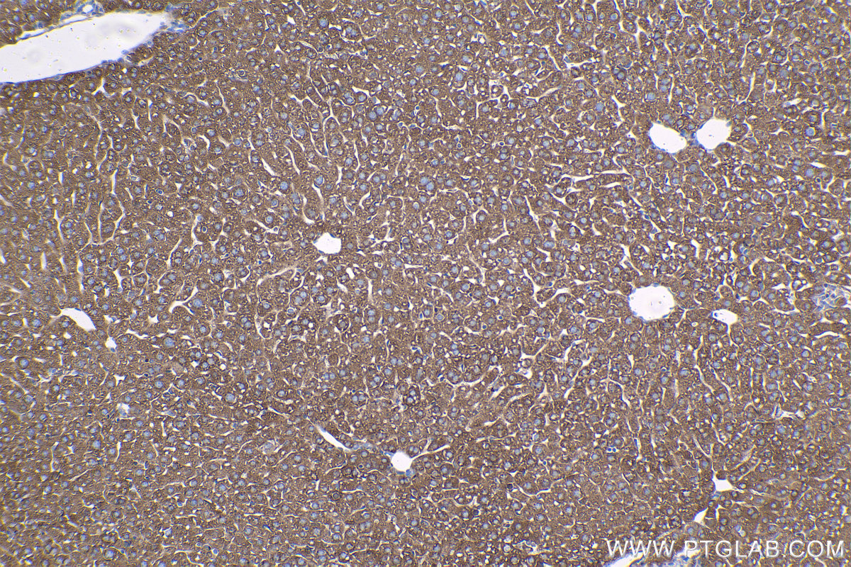 Immunohistochemical analysis of paraffin-embedded mouse liver tissue slide using KHC1363 (LAMP2 IHC Kit).