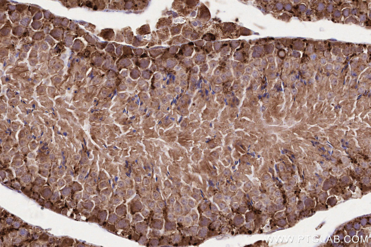 Immunohistochemical analysis of paraffin-embedded mouse testis tissue slide using KHC2577 (LAMTOR1 IHC Kit).
