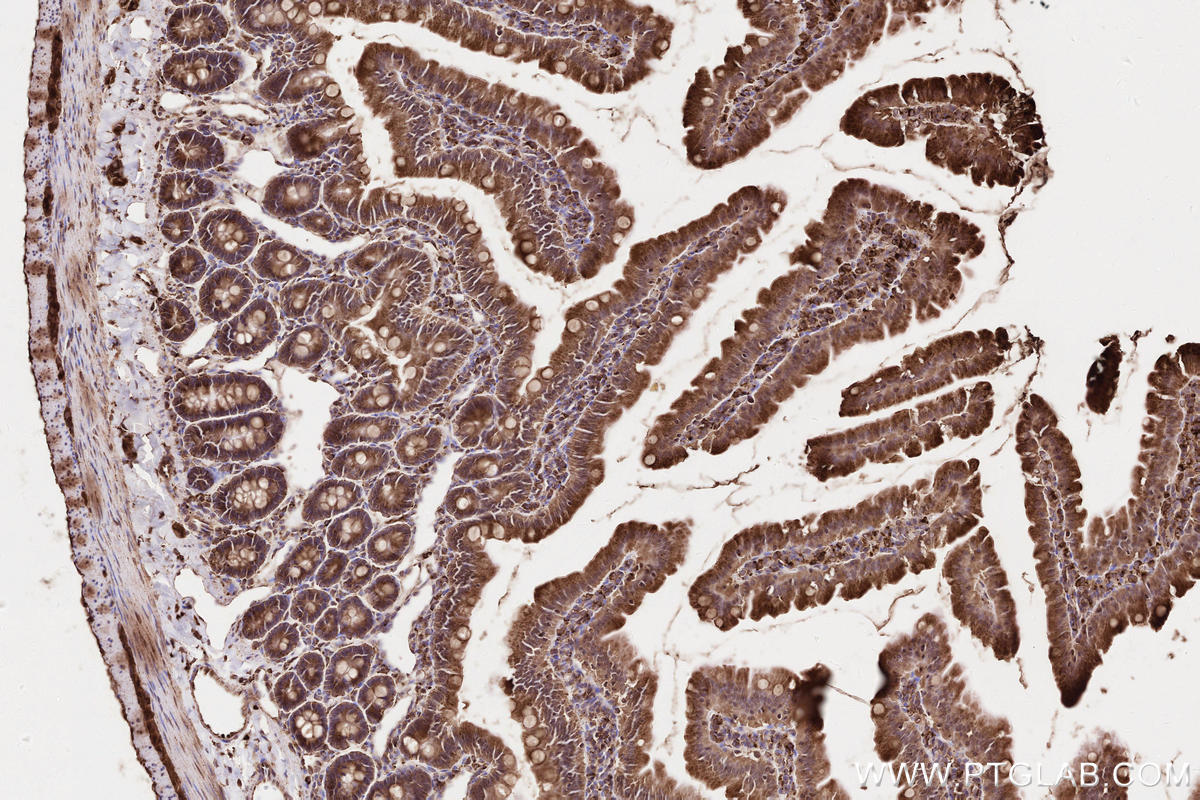 Immunohistochemical analysis of paraffin-embedded rat small intestine tissue slide using KHC2577 (LAMTOR1 IHC Kit).