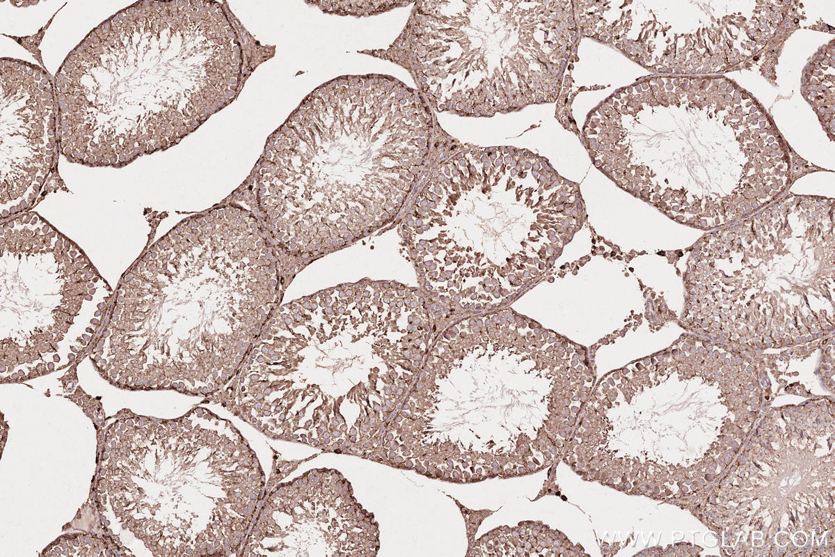 Immunohistochemical analysis of paraffin-embedded rat testis tissue slide using KHC2577 (LAMTOR1 IHC Kit).