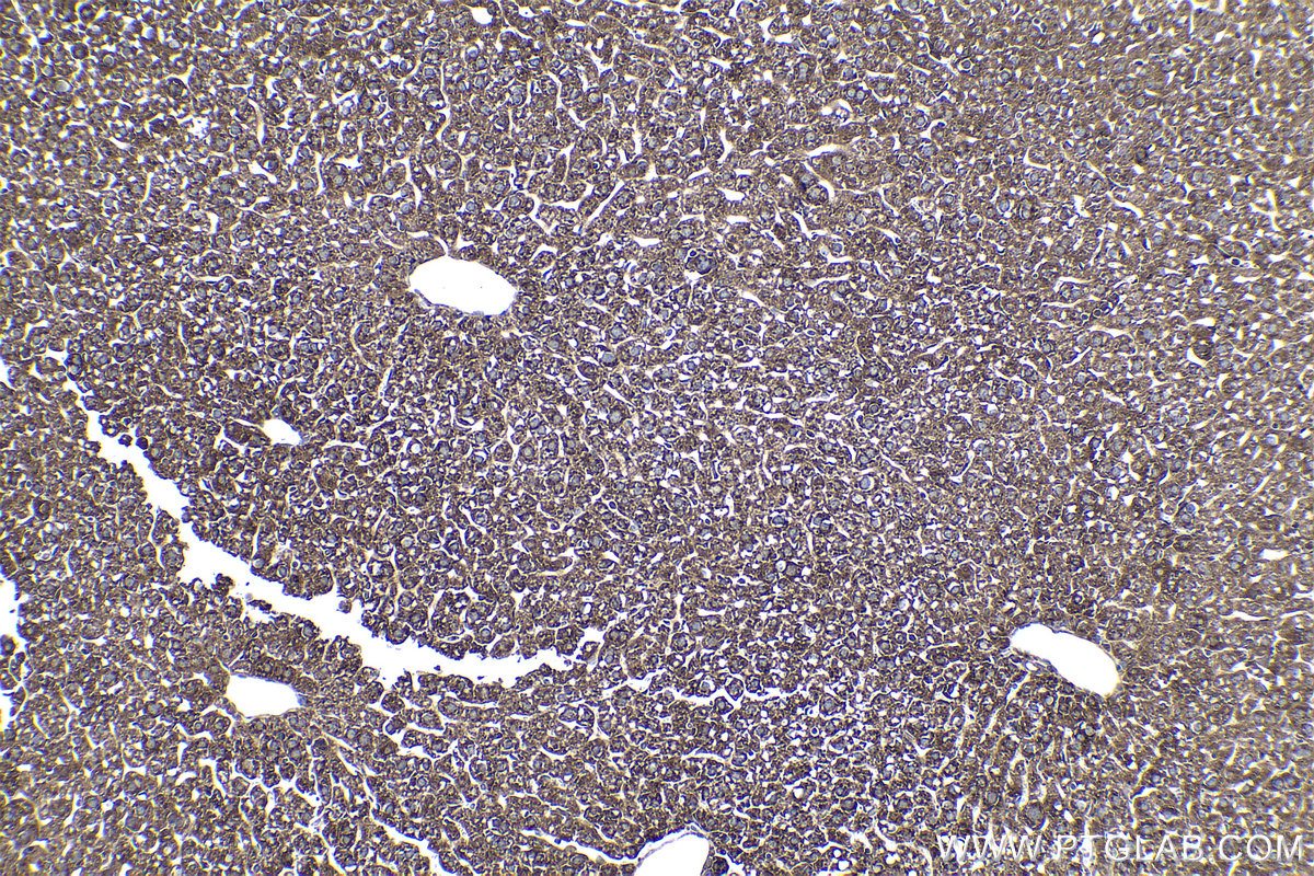 Immunohistochemical analysis of paraffin-embedded mouse liver tissue slide using KHC1005 (LARP1 IHC Kit).