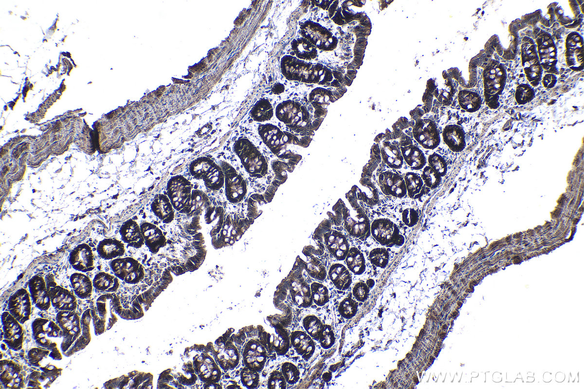 Immunohistochemical analysis of paraffin-embedded rat colon tissue slide using KHC1005 (LARP1 IHC Kit).