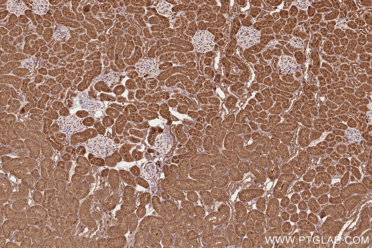 Immunohistochemical analysis of paraffin-embedded rat kidney tissue slide using KHC2609 (LARP4 IHC Kit).