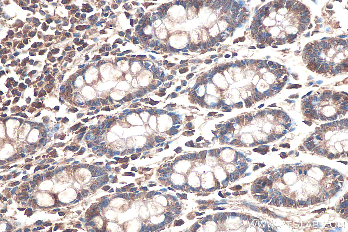Immunohistochemical analysis of paraffin-embedded human colon tissue slide using KHC0866 (LARS1 IHC Kit).