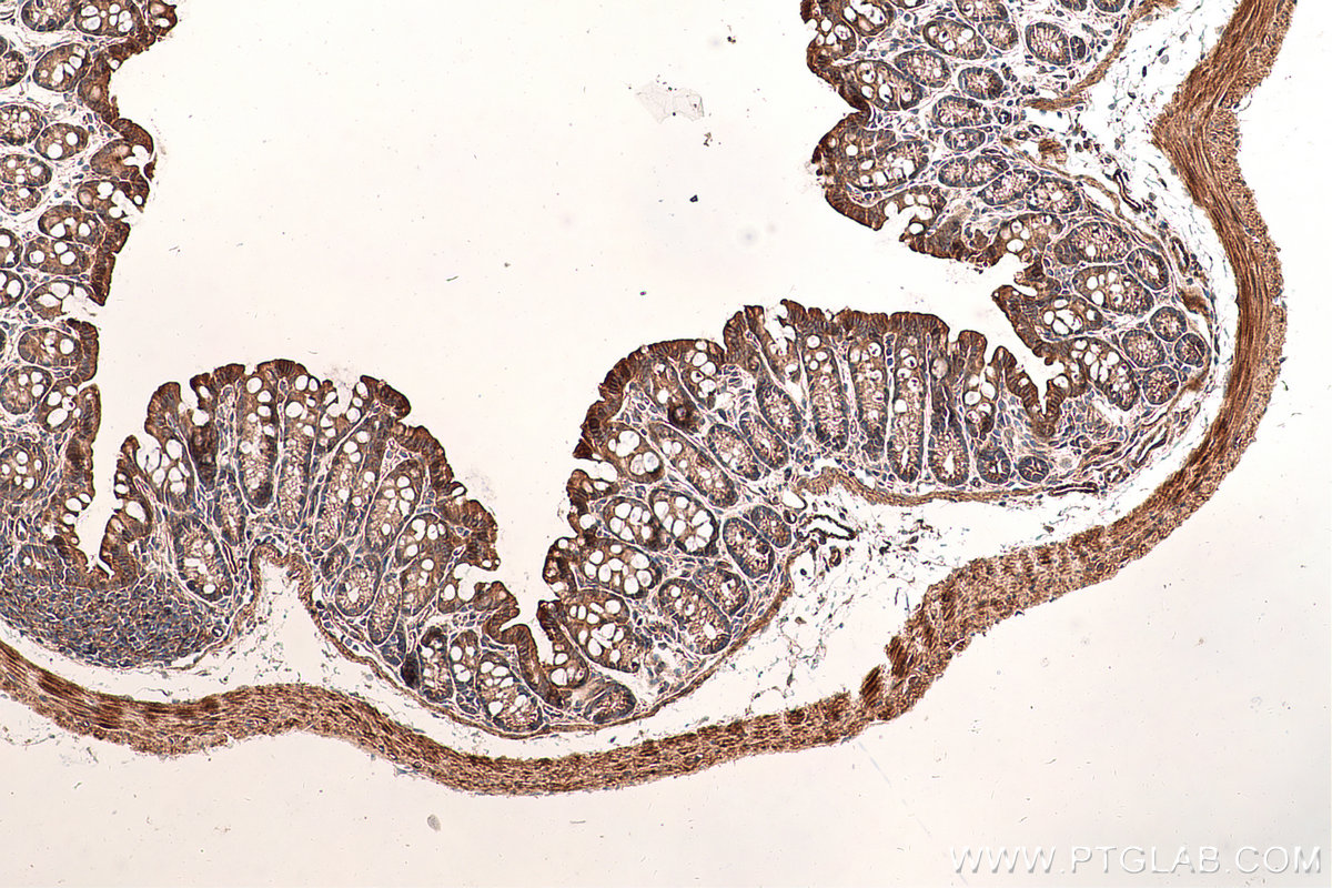 Immunohistochemical analysis of paraffin-embedded mouse colon tissue slide using KHC0676 (LASP1 IHC Kit).