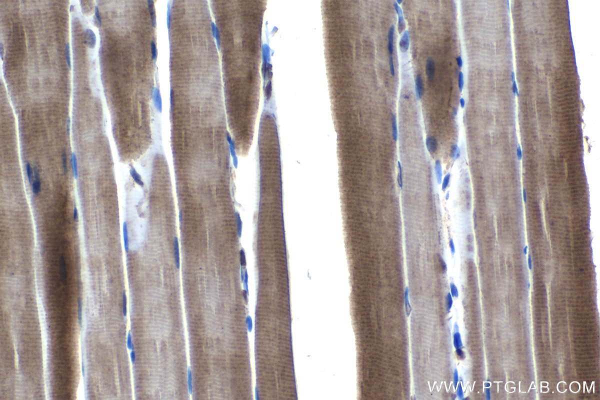 Immunohistochemical analysis of paraffin-embedded rat skeletal muscle tissue slide using KHC1245 (LATS2 IHC Kit).