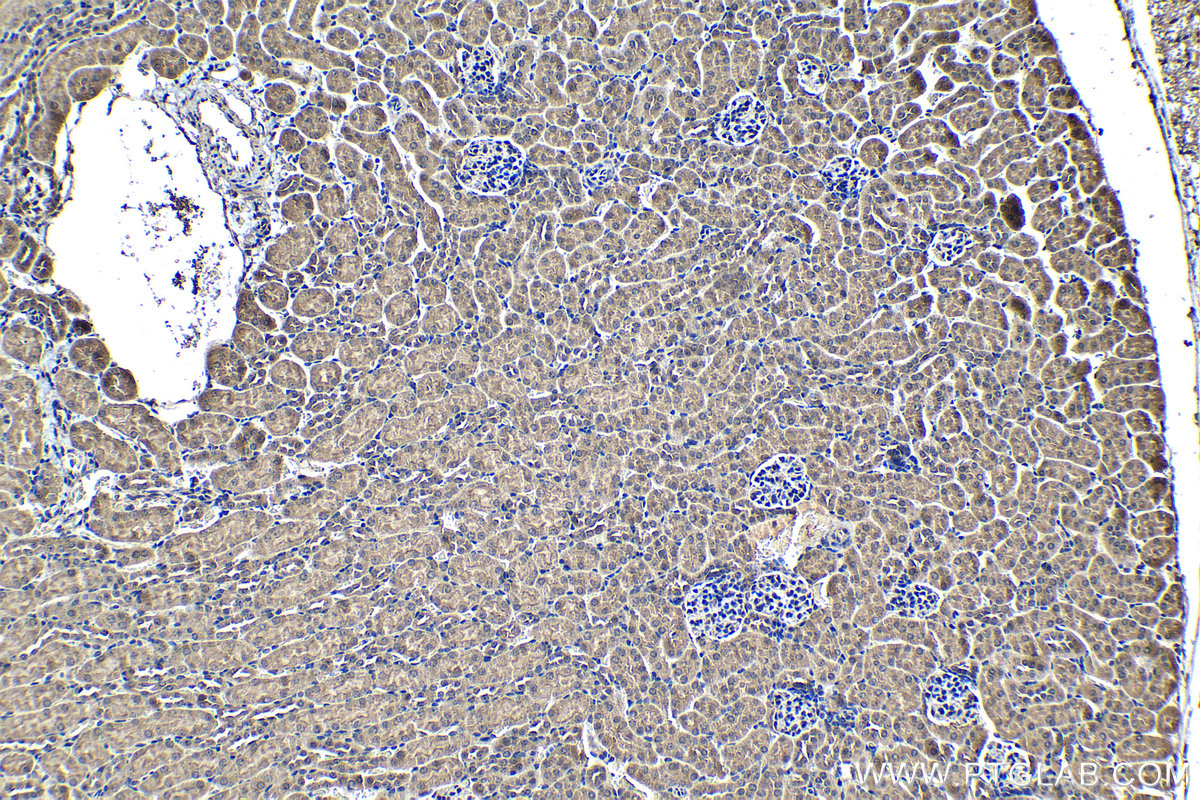 Immunohistochemical analysis of paraffin-embedded mouse kidney tissue slide using KHC1245 (LATS2 IHC Kit).