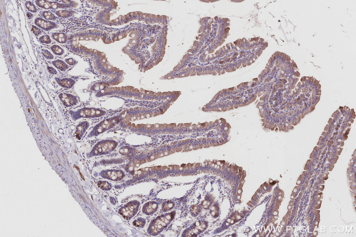 Immunohistochemical analysis of paraffin-embedded rat small intestine tissue slide using KHC3012 (LCMT1 IHC Kit). Immunohistochemical analysis of paraffin-embedded rat small intestine tissue slide using KHC3012 (LCMT1 IHC Kit).