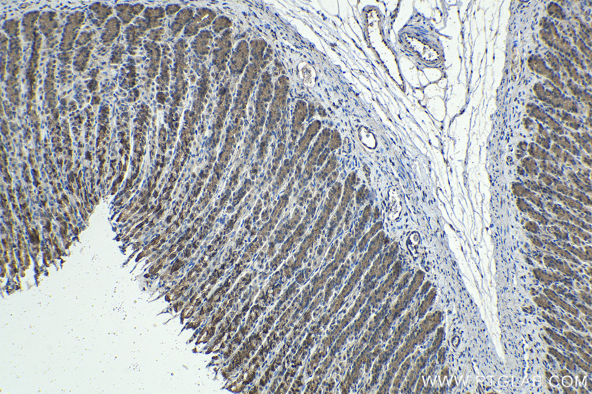 Immunohistochemical analysis of paraffin-embedded rat stomach tissue slide using KHC1418 (LGALS9 IHC Kit).