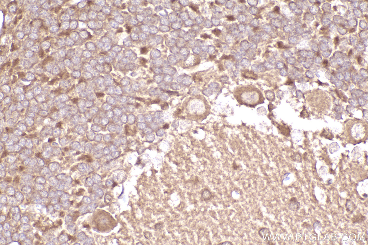 Immunohistochemical analysis of paraffin-embedded rat cerebellum tissue slide using KHC2272 (LIS1 IHC Kit).