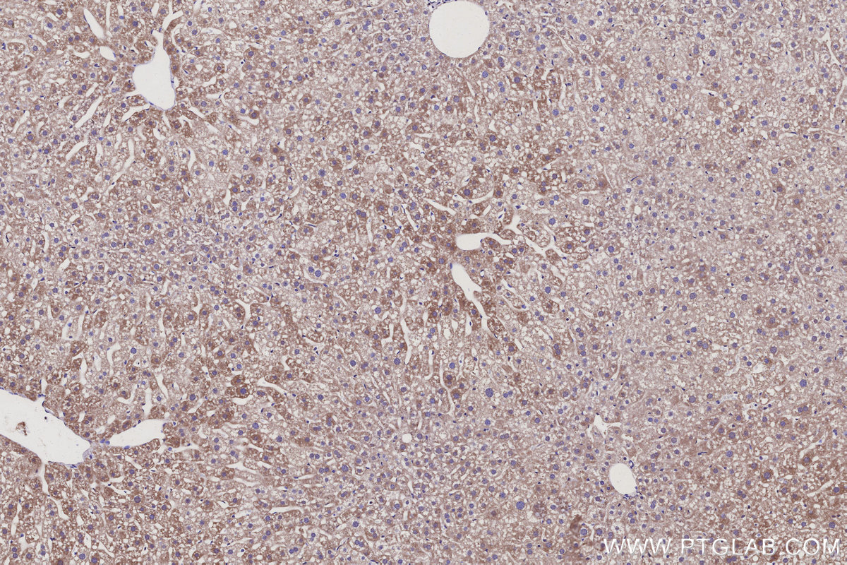 Immunohistochemical analysis of paraffin-embedded mouse liver tissue slide using KHC3116 (LMF2 IHC Kit). Immunohistochemical analysis of paraffin-embedded mouse liver tissue slide using KHC3116 (LMF2 IHC Kit).