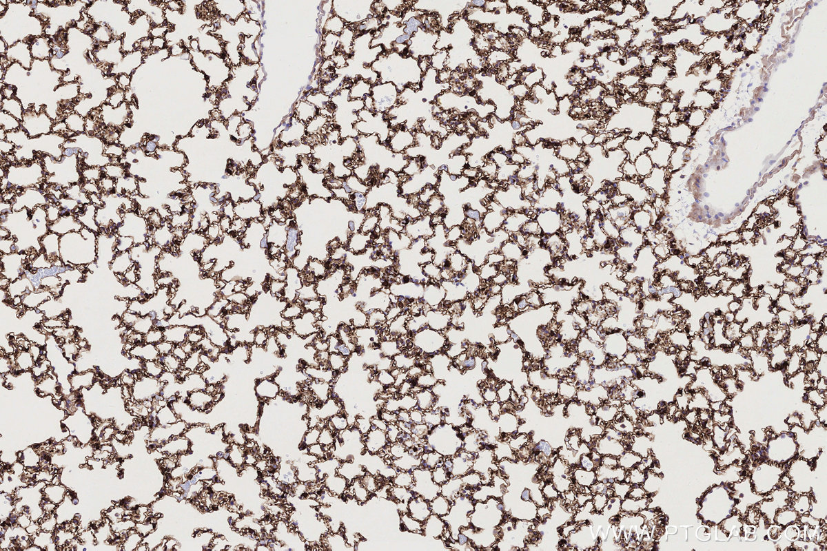 Immunohistochemical analysis of paraffin-embedded mouse lung tissue slide using KHC2738 (LMO7 IHC Kit).