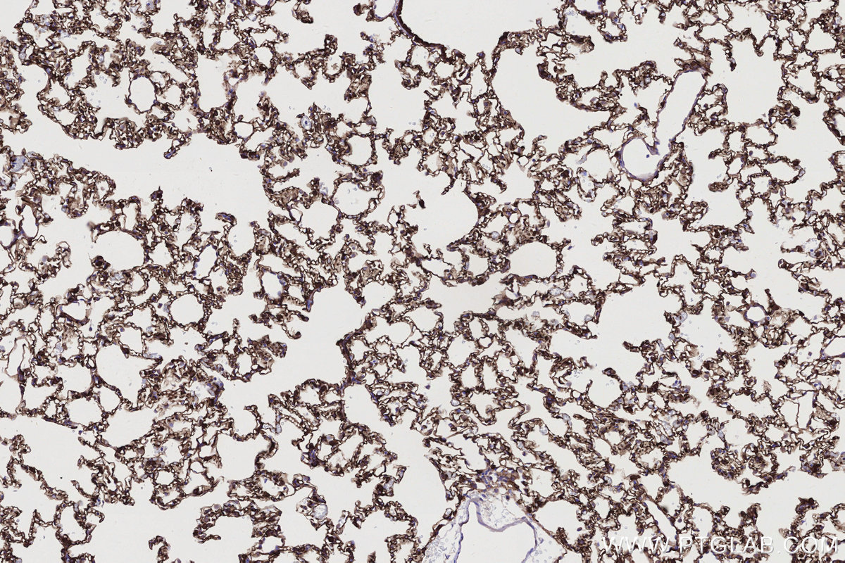 Immunohistochemical analysis of paraffin-embedded rat lung tissue slide using KHC2738 (LMO7 IHC Kit).