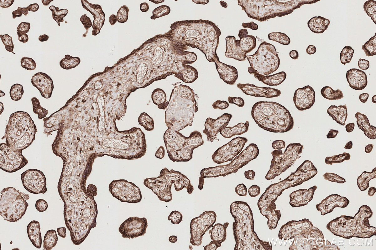 Immunohistochemical analysis of paraffin-embedded human placenta tissue slide using KHC2893 (LNPK/KIAA1715 IHC Kit).