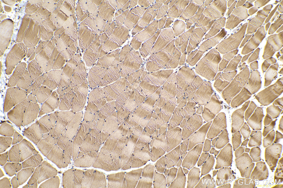 Immunohistochemical analysis of paraffin-embedded rat skeletal muscle tissue slide using KHC0630 (LOX IHC Kit).