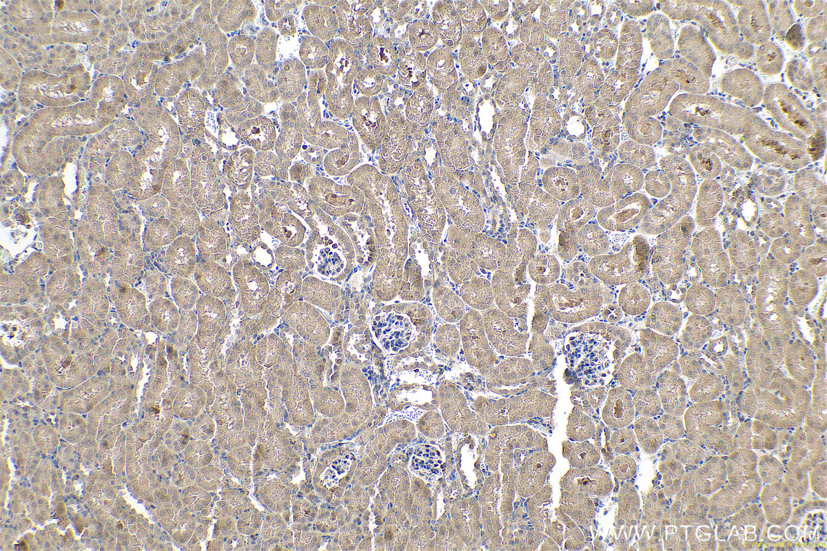 Immunohistochemical analysis of paraffin-embedded mouse kidney tissue slide using KHC0630 (LOX IHC Kit).