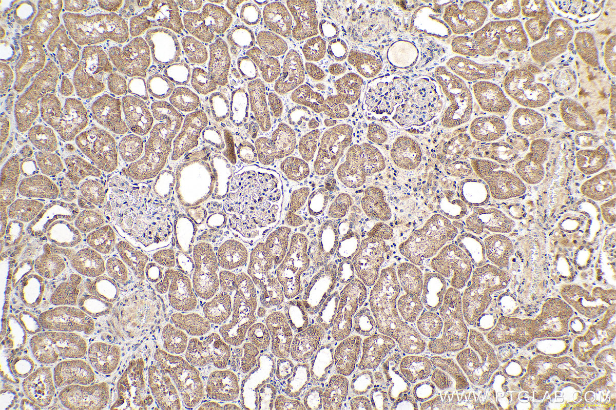 Immunohistochemical analysis of paraffin-embedded human kidney tissue slide using KHC0630 (LOX IHC Kit).