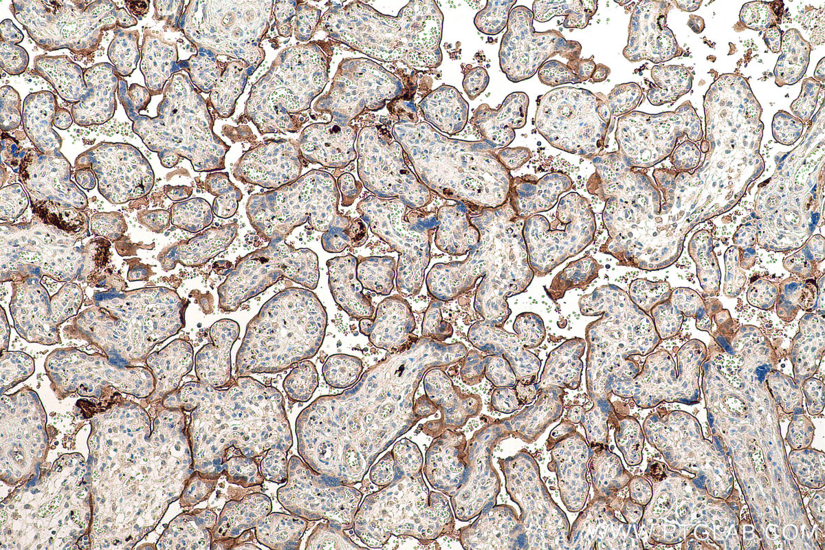 Immunohistochemical analysis of paraffin-embedded human placenta tissue slide using KHC0823 (LOXL2 IHC Kit).