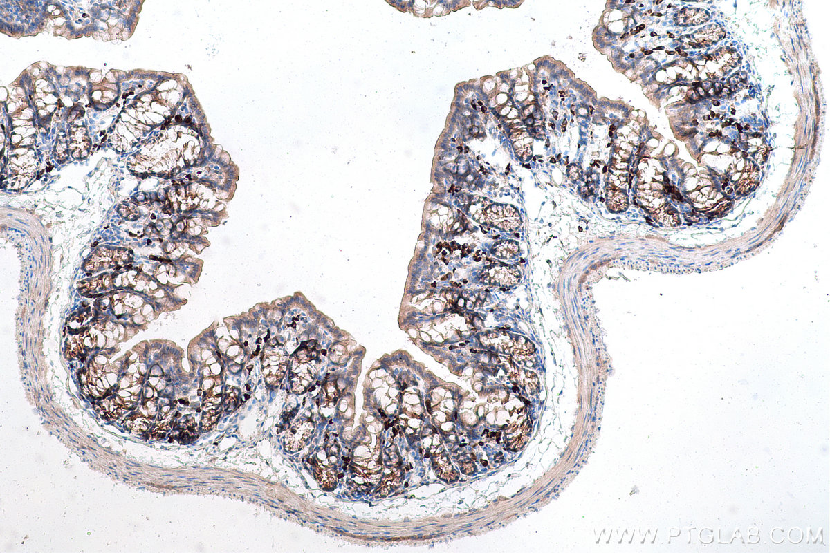 Immunohistochemical analysis of paraffin-embedded mouse colon tissue slide using KHC0823 (LOXL2 IHC Kit).