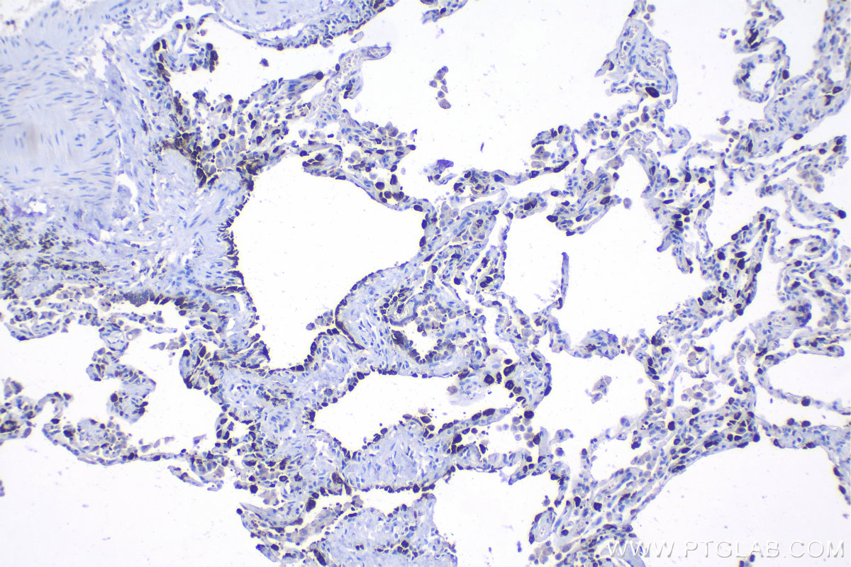 Immunohistochemical analysis of paraffin-embedded human lung tissue slide using KHC1097 (LPCAT1 IHC Kit).