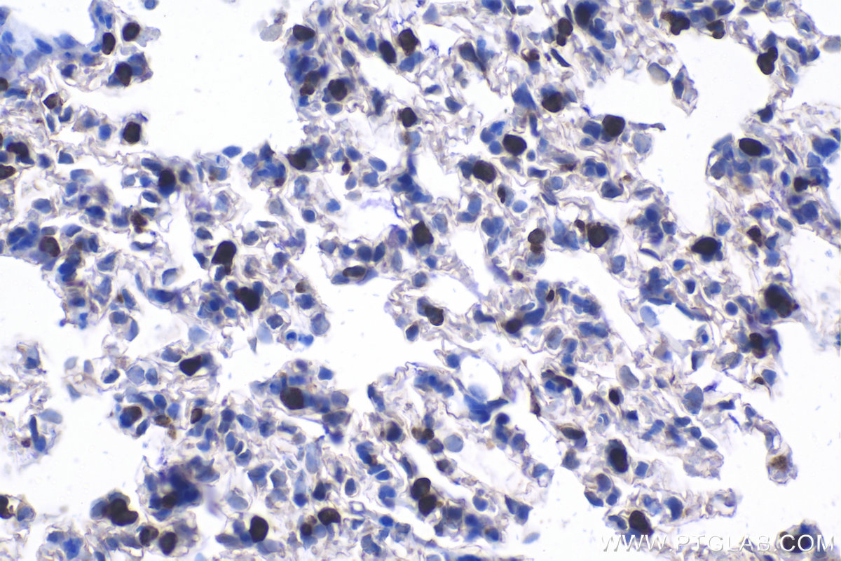 Immunohistochemical analysis of paraffin-embedded rat lung tissue slide using KHC1097 (LPCAT1 IHC Kit).